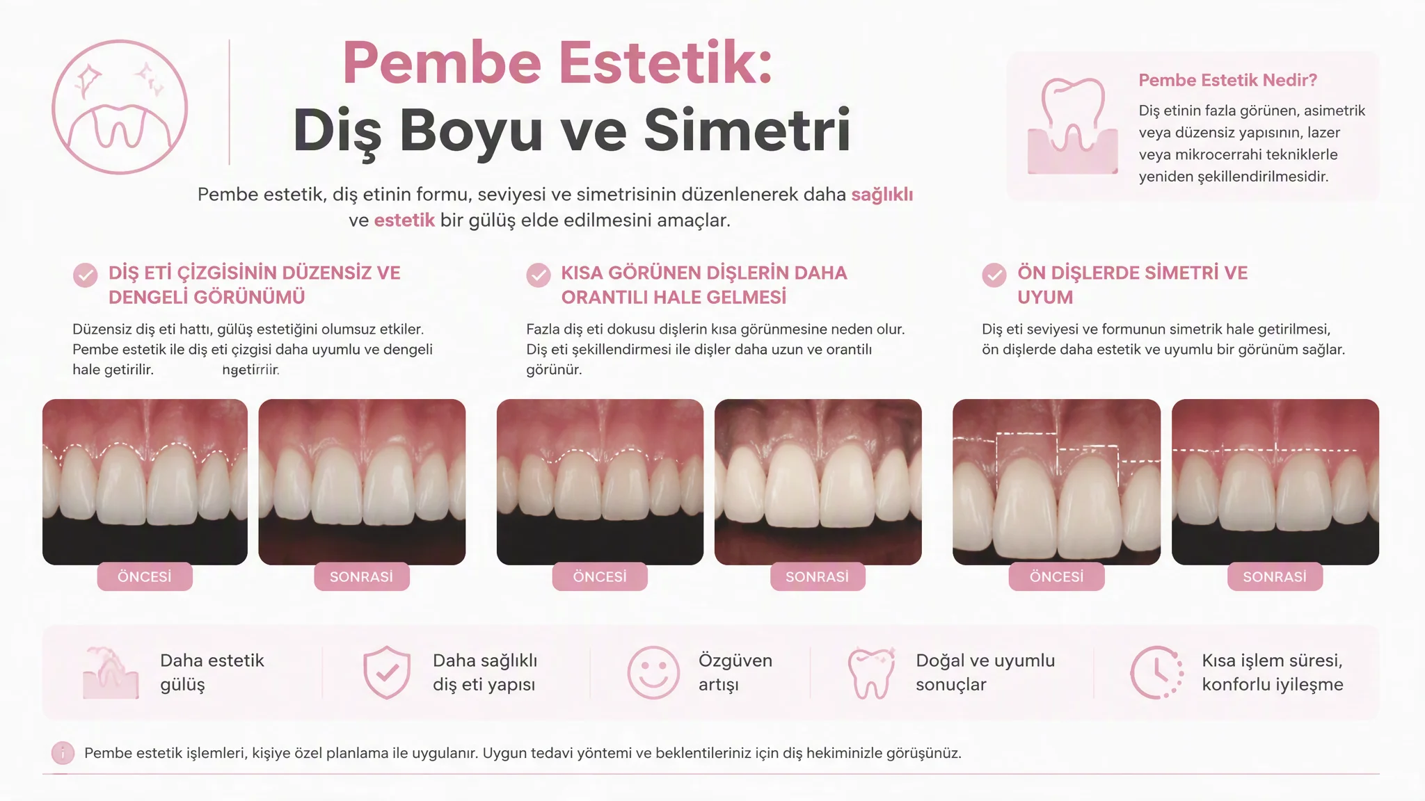 Pembe Estetik (Diş Eti Estetiği) Nedir? Diş Boyu ve Simetri Neden Önemlidir?