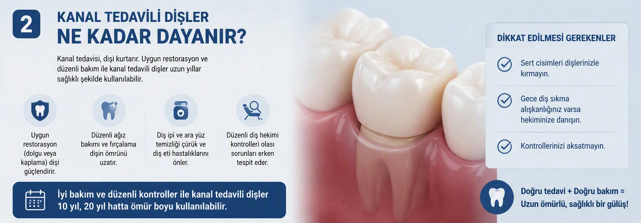 Kanal Tedavili Dişler Ne Kadar Dayanır? Ömürlük Olması İçin Ne Yapılmalı?