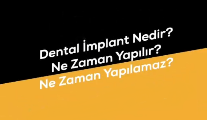 Dental İmplant Ne Zaman Yapılabilir? | Prof. Dr. İbrahim Duran